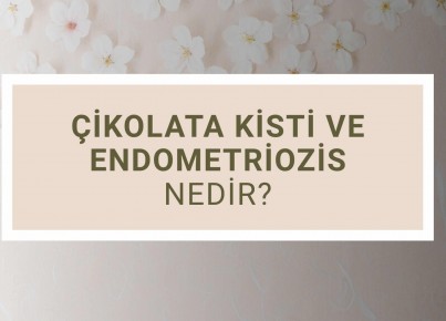What are Chocolate Cysts and Endometriosis?
